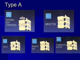 TTyyppee AA 
- 1 
- 3 
 