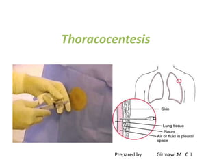 Thoracocentesis
Prepared by Girmawi.M C II
 