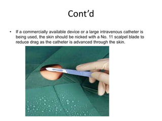 Cont’d
• If a commercially available device or a large intravenous catheter is
being used, the skin should be nicked with a No. 11 scalpel blade to
reduce drag as the catheter is advanced through the skin.
 