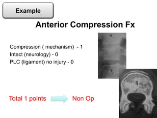 Compression ( mechanism) - 1
Intact (neurology) - 0
PLC (ligament) no injury - 0
Anterior Compression Fx
Total 1 points Non Op
Example
 