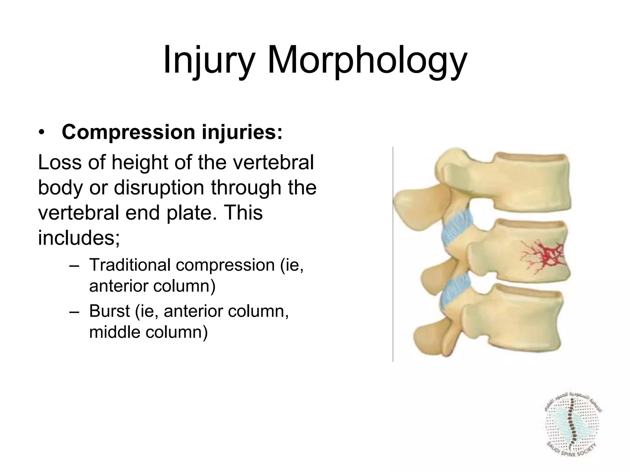 Thoracolumbar-spine-fracture-.ppt