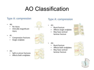 AO Classification
 