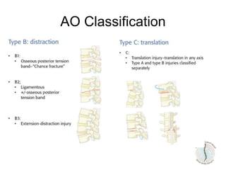 AO Classification
 