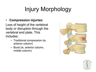 Injury Morphology
• Compression injuries:
Loss of height of the vertebral
body or disruption through the
vertebral end plate. This
includes;
– Traditional compression (ie,
anterior column)
– Burst (ie, anterior column,
middle column)
 