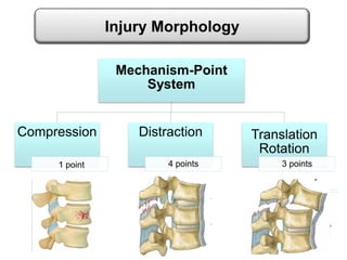 Mechanism-Point
System
Compression
1 point
Distraction
4 points
Translation
Rotation
3 points
Injury Morphology
 