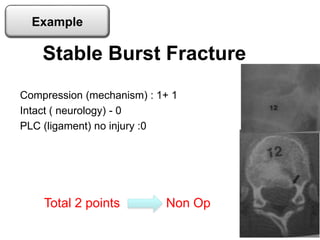 Compression (mechanism) : 1+ 1
Intact ( neurology) - 0
PLC (ligament) no injury :0
Stable Burst Fracture
Total 2 points Non Op
Example
 