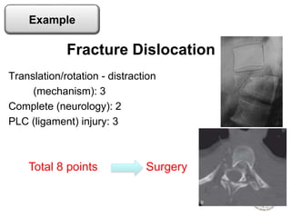 Translation/rotation - distraction
(mechanism): 3
Complete (neurology): 2
PLC (ligament) injury: 3
Fracture Dislocation
Total 8 points Surgery
Example
 