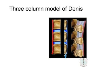 Three column model of Denis
 