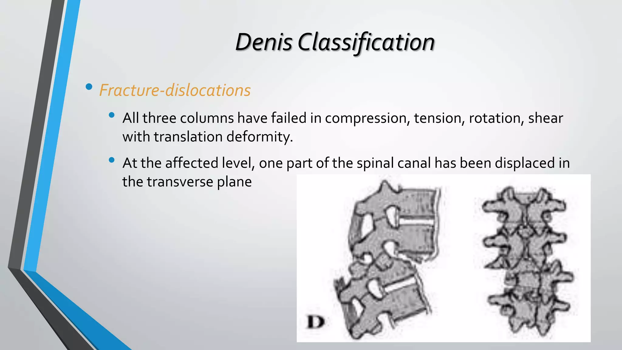 Denis Classification
• Fracture-dislocations
• All three columns have failed in compression, tension, rotation, shear
with translation deformity.
• At the affected level, one part of the spinal canal has been displaced in
the transverse plane
 