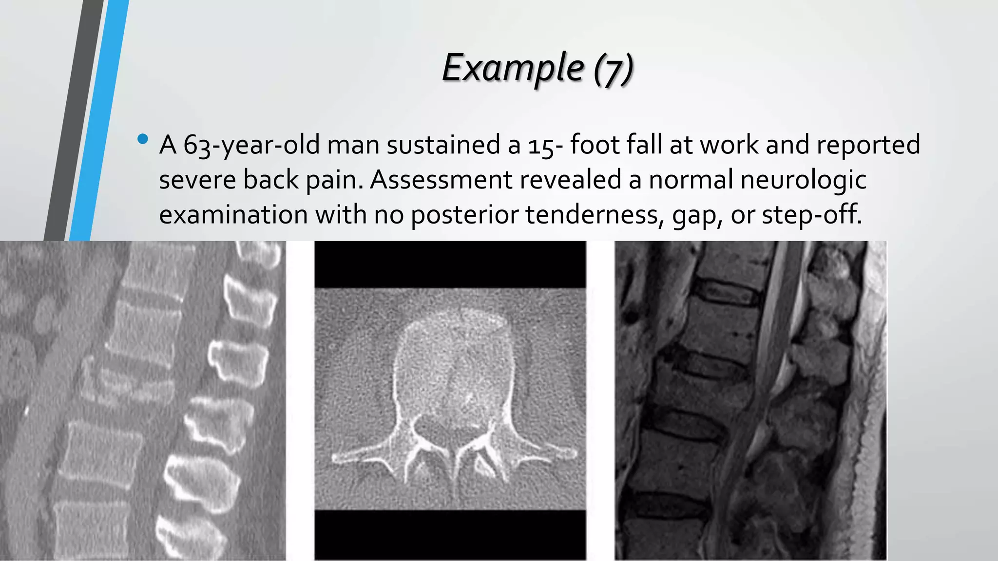 Example (7)
• A 63-year-old man sustained a 15- foot fall at work and reported
severe back pain. Assessment revealed a normal neurologic
examination with no posterior tenderness, gap, or step-off.
 