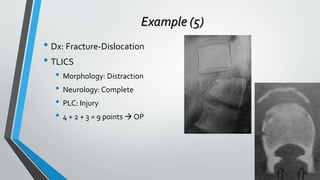 Dcapblstic Thoracolumbar fractures classification | PPTX