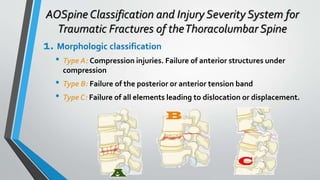 Thoracolumbar fractures classification | PPTX