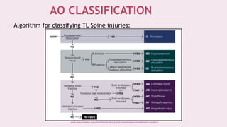 Thoracolumbar Injuries for MBBS undergraduates | PPTX