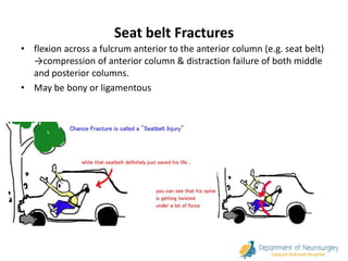 Thoracolumber fractures | PPT