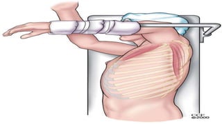 THORACOTOMY INCISION ppt by Dr. Amrit kumar | PPTX