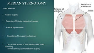 THORACOTOMY INCISION ppt by Dr. Amrit kumar | PPTX