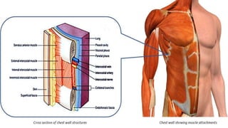 THORACOTOMY INCISION ppt by Dr. Amrit kumar | PPTX