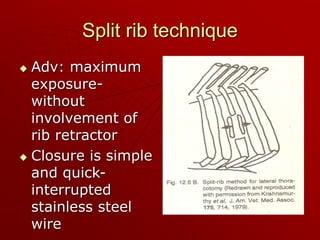 Split Rib Austral Thoracic Surgery | PPT