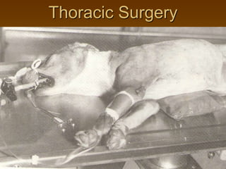Thoracic Surgery
 