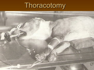Thoracotomy
 