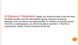 4) Exposure / Penetration: Ideally, you should be able to see the heart,
the blood vessels, and the intervertebral spaces. Exposure should be
adequate if you are able to see approximately T4 vertebra and spinal process.
If the film is underexposed, you will not be able to see them . If the film is
overexposed, details of bone structures will be lost .
 