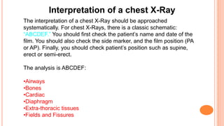 The interpretation of a chest X-Ray should be approached
systematically. For chest X-Rays, there is a classic schematic:
“ABCDEF.” You should first check the patient’s name and date of the
film. You should also check the side marker, and the film position (PA
or AP). Finally, you should check patient’s position such as supine,
erect or semi-erect.
The analysis is ABCDEF:
•Airways
•Bones
•Cardiac
•Diaphragm
•Extra-thoracic tissues
•Fields and Fissures
Interpretation of a chest X-Ray
 