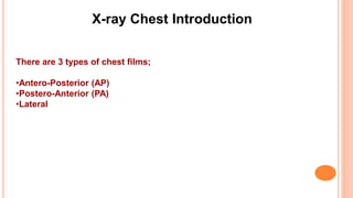 There are 3 types of chest films;
•Antero-Posterior (AP)
•Postero-Anterior (PA)
•Lateral
X-ray Chest Introduction
 