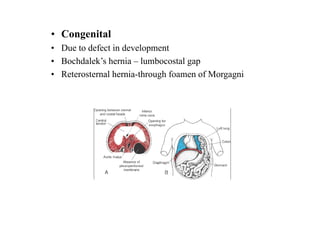 • Congenital
• Due to defect in development
• Bochdalek’s hernia – lumbocostal gap
• Reterosternal hernia-through foamen of Morgagni
 