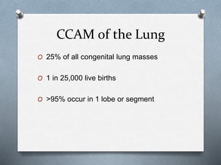 CCAM of the Lung
O 25% of all congenital lung masses
O 1 in 25,000 live births
O >95% occur in 1 lobe or segment
 