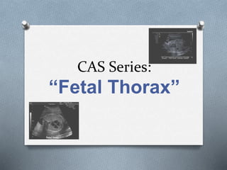 CAS Series:
“Fetal Thorax”
 