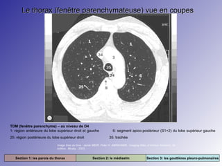 Le thorax (fenêtre parenchymateuse) vue en coupes

TDM (fenêtre parenchyme) – au niveau de D4
1: région antérieure du lobe supérieur droit et gauche
25: région postérieure du lobe supérieur droit

6: segment apico-postérieur (S1+2) du lobe supérieur gauche
35: trachée

Image tirée du livre : Jamie WEIR. Peter H. ABRAHAMS. Imaging Atlas of Human Anatomy. 3e
édition. Mosby. 2003.

Section 1: les parois du thorax

Section 2: le médiastin

Section 3: les gouttières pleuro-pulmonaires

 