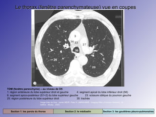 Le thorax (fenêtre parenchymateuse) vue en coupes

TDM (fenêtre parenchyme) – au niveau de D5
1: région antérieure du lobe supérieur droit et gauche
4: segment apical du lobe inférieur droit (S6)
6: segment apico-postérieur (S1+2) du lobe supérieur gauche
23: scissure oblique du poumon gauche
25: région postérieure du lobe supérieur droit
35: trachée
Image tirée du livre : Jamie WEIR. Peter H. ABRAHAMS. Imaging Atlas of Human Anatomy. 3e
édition. Mosby. 2003.

Section 1: les parois du thorax

Section 2: le médiastin

Section 3: les gouttières pleuro-pulmonaires

 