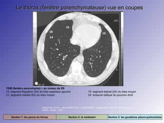 Le thorax (fenêtre parenchymateuse) vue en coupes

TDM (fenêtre parenchyme) – au niveau de D9
10: segment lingulaire (S4) du lobe supérieur gauche
21: segment médial (S5) du lobe moyen

15: segment latéral (S4) du lobe moyen
24: scissure oblique du poumon droit

Image tirée du livre : Jamie WEIR. Peter H. ABRAHAMS. Imaging Atlas of Human Anatomy. 3e
édition. Mosby. 2003.

Section 1: les parois du thorax

Section 2: le médiastin

Section 3: les gouttières pleuro-pulmonaires

 