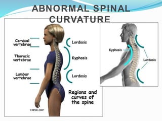 ABNORMAL SPINAL
CURVATURE
 