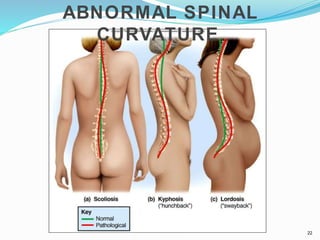 ABNORMAL SPINAL
CURVATURE
22
 