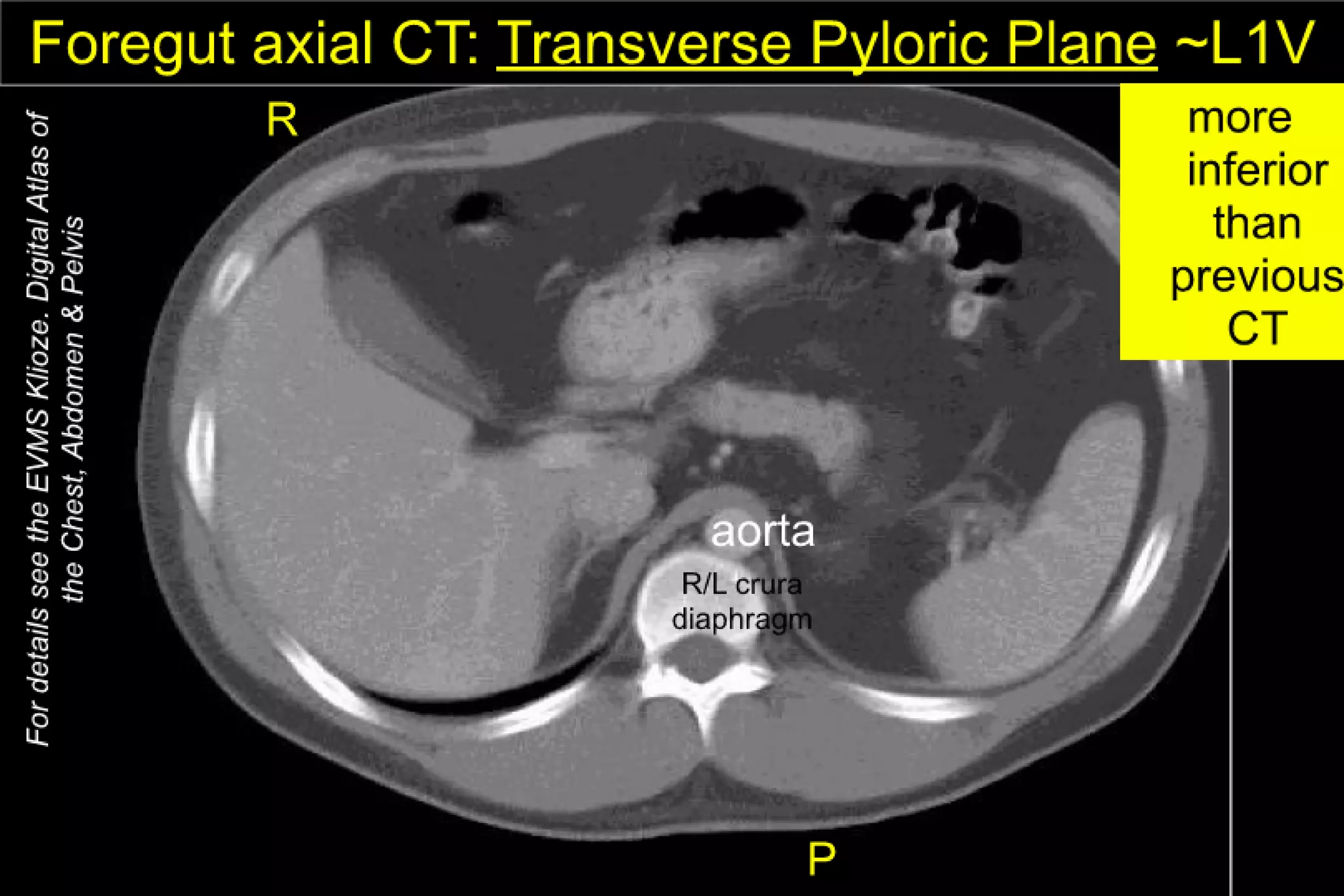 Thorax and Abdomen CT Cheat Sheet
