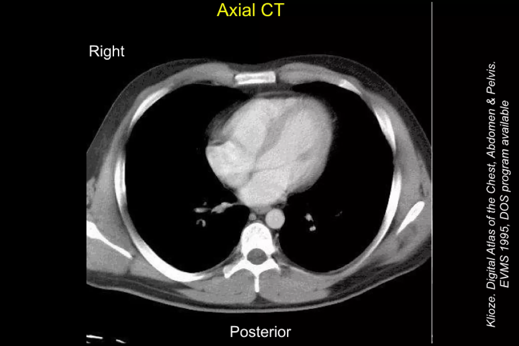 Thorax and Abdomen CT Cheat Sheet