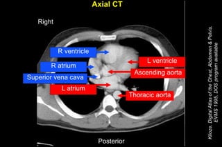 Thorax and Abdomen CT Cheat Sheet | PDF