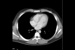 Thorax and Abdomen CT Cheat Sheet | PDF
