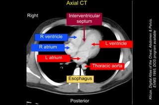 Thorax and Abdomen CT Cheat Sheet | PDF