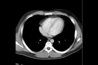 Thorax and Abdomen CT Cheat Sheet | PDF