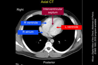 Thorax and Abdomen CT Cheat Sheet | PDF