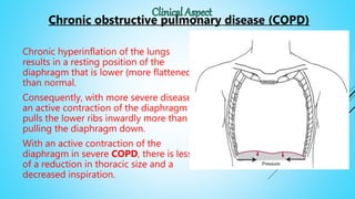 Chronic hyperinflation of the lungs
results in a resting position of the
diaphragm that is lower (more flattened)
than normal.
Consequently, with more severe disease,
an active contraction of the diaphragm
pulls the lower ribs inwardly more than
pulling the diaphragm down.
With an active contraction of the
diaphragm in severe COPD, there is less
of a reduction in thoracic size and a
decreased inspiration.
Chronic obstructive pulmonary disease (COPD)
 