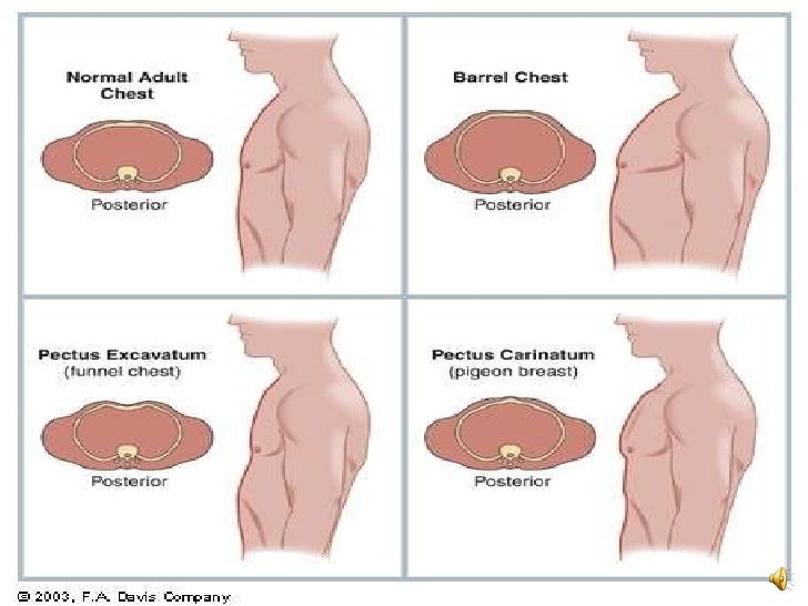 Thorax And Lungs.330.Ss.09