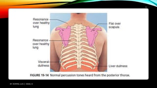 BY: ROMMEL LUIS C. ISRAEL III
11
 