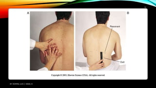 BY: ROMMEL LUIS C. ISRAEL III
12
 