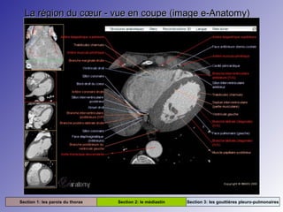La région du cœur - vue en coupe (image e-Anatomy)La région du cœur - vue en coupe (image e-Anatomy)
Section 1: les parois du thorax Section 2: le médiastin Section 3: les gouttières pleuro-pulmonaires
 