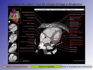 La région du cœur - vue en coupe (image e-Anatomy)La région du cœur - vue en coupe (image e-Anatomy)
Section 1: les parois du thorax Section 2: le médiastin Section 3: les gouttières pleuro-pulmonaires
 