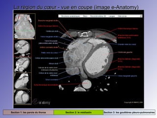 La région du cœur - vue en coupe (image e-Anatomy)La région du cœur - vue en coupe (image e-Anatomy)
Section 1: les parois du thorax Section 2: le médiastin Section 3: les gouttières pleuro-pulmonaires
 