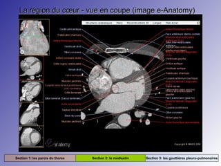 La région du cœur - vue en coupe (image e-Anatomy)La région du cœur - vue en coupe (image e-Anatomy)
Section 1: les parois du thorax Section 2: le médiastin Section 3: les gouttières pleuro-pulmonaires
 